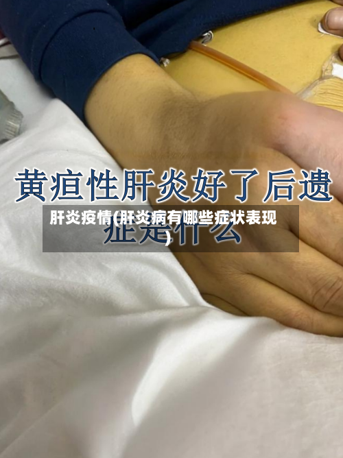 肝炎疫情(肝炎病有哪些症状表现)-第2张图片