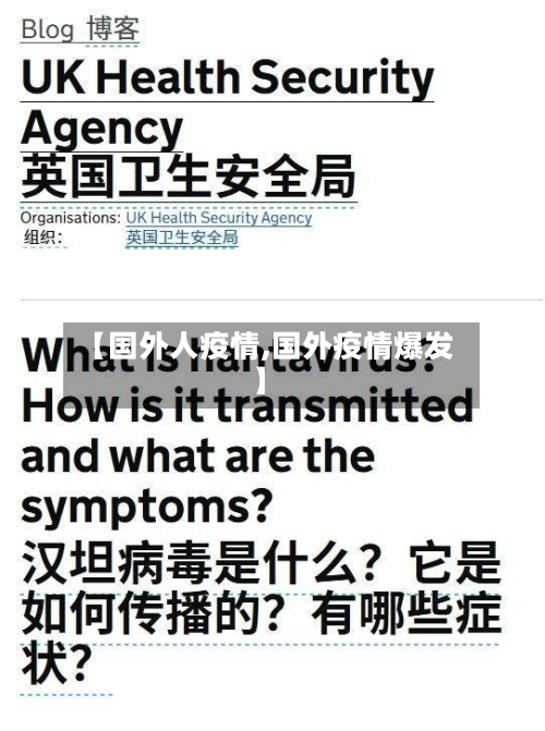 【国外人疫情,国外疫情爆发】-第2张图片