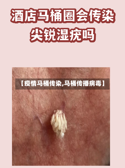 【疫情马桶传染,马桶传播病毒】