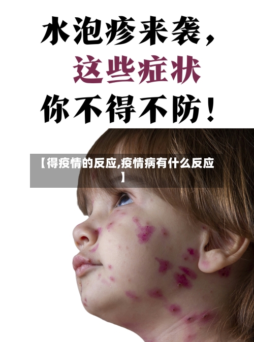 【得疫情的反应,疫情病有什么反应】-第2张图片