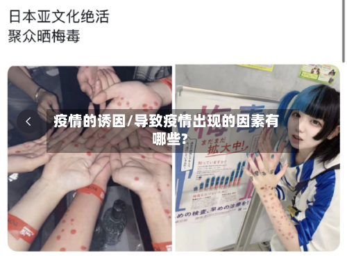 疫情的诱因/导致疫情出现的因素有哪些?-第2张图片