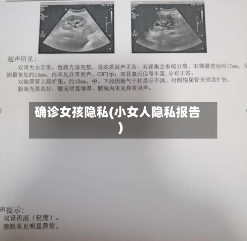 确诊女孩隐私(小女人隐私报告)