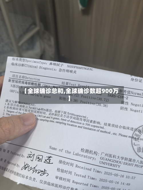 【全球确诊总和,全球确诊数超900万】-第3张图片