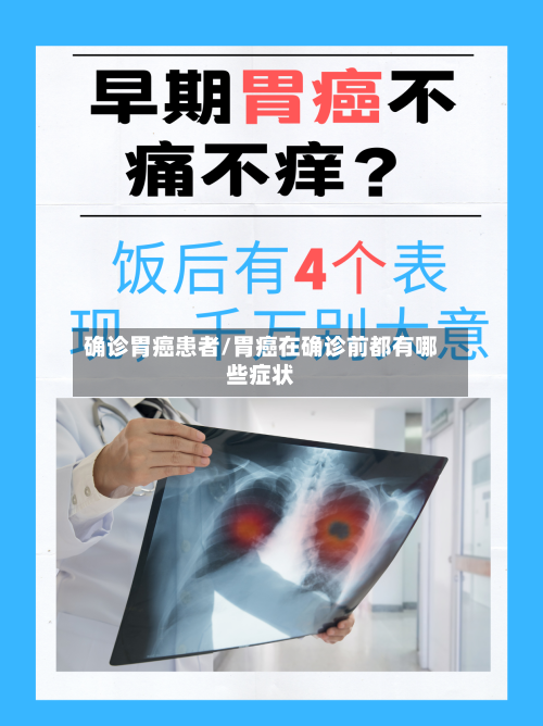 确诊胃癌患者/胃癌在确诊前都有哪些症状-第2张图片