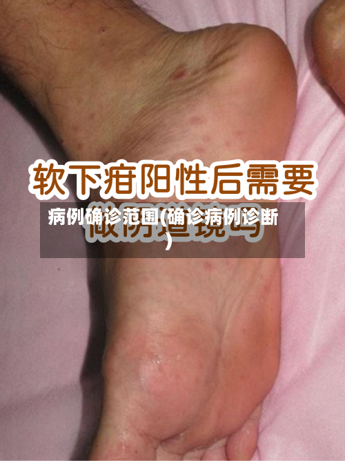 病例确诊范围(确诊病例诊断)