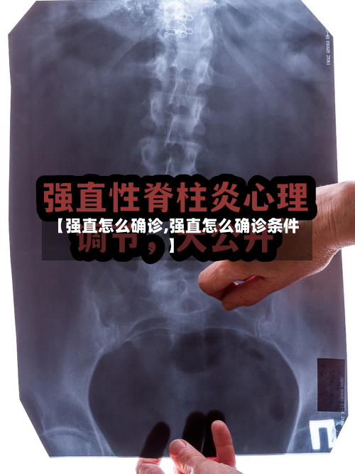 【强直怎么确诊,强直怎么确诊条件】-第3张图片