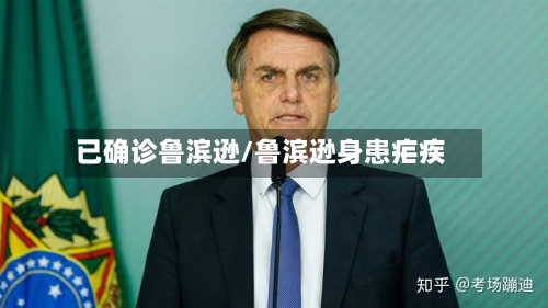 已确诊鲁滨逊/鲁滨逊身患疟疾-第2张图片